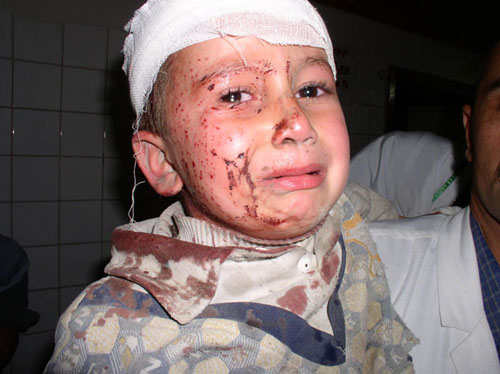 Iraq Child