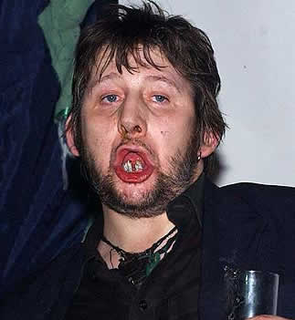 Shane MacGowan